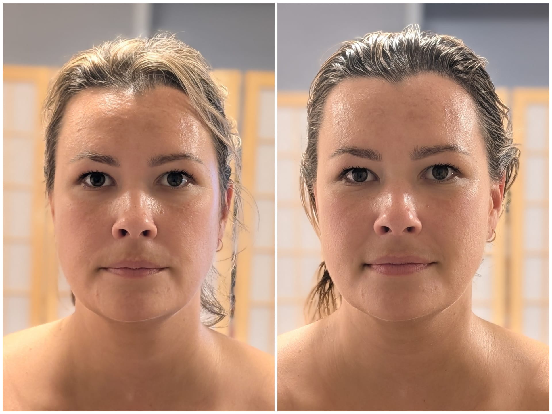 Before and after facial lymphatic drainage massage showing smoother, de-puffed skin, Noosa