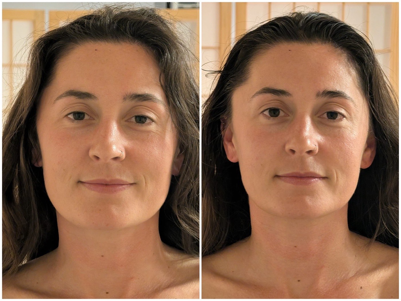 Before and after facial lymphatic drainage massage, Clem