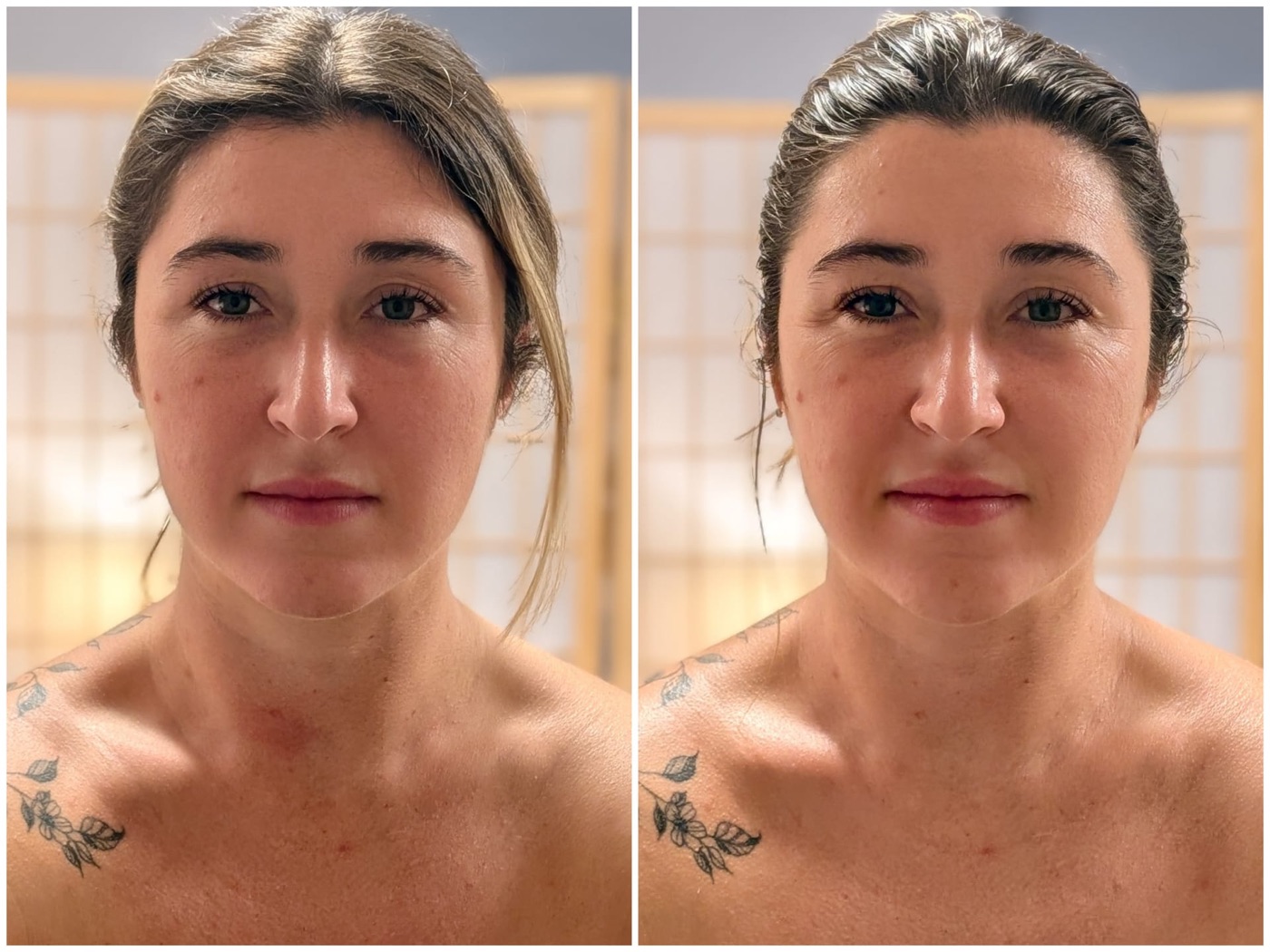 Before and after facial lymphatic drainage massage, Isi