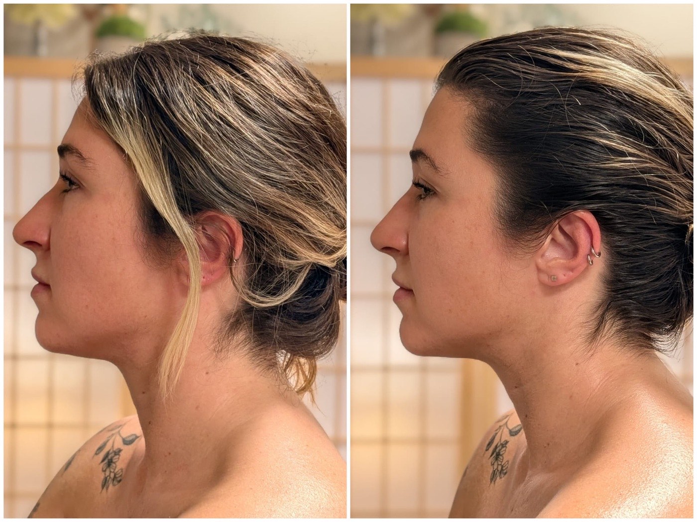 Before and after facial lymphatic drainage, side profile view