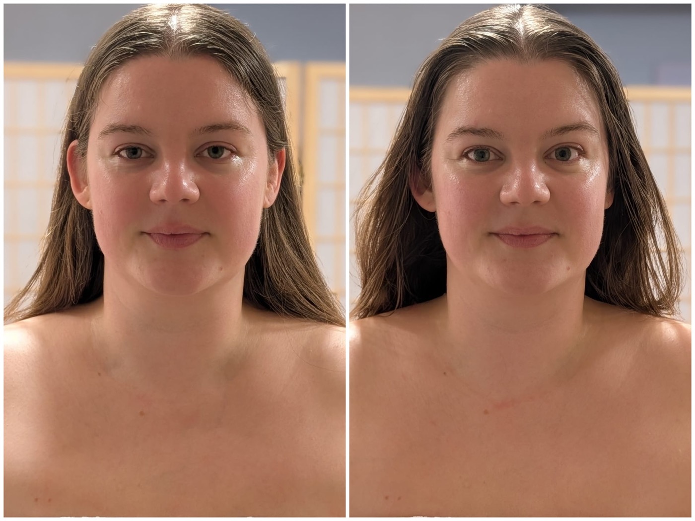 Before and after facial lymphatic drainage massage, Marie S