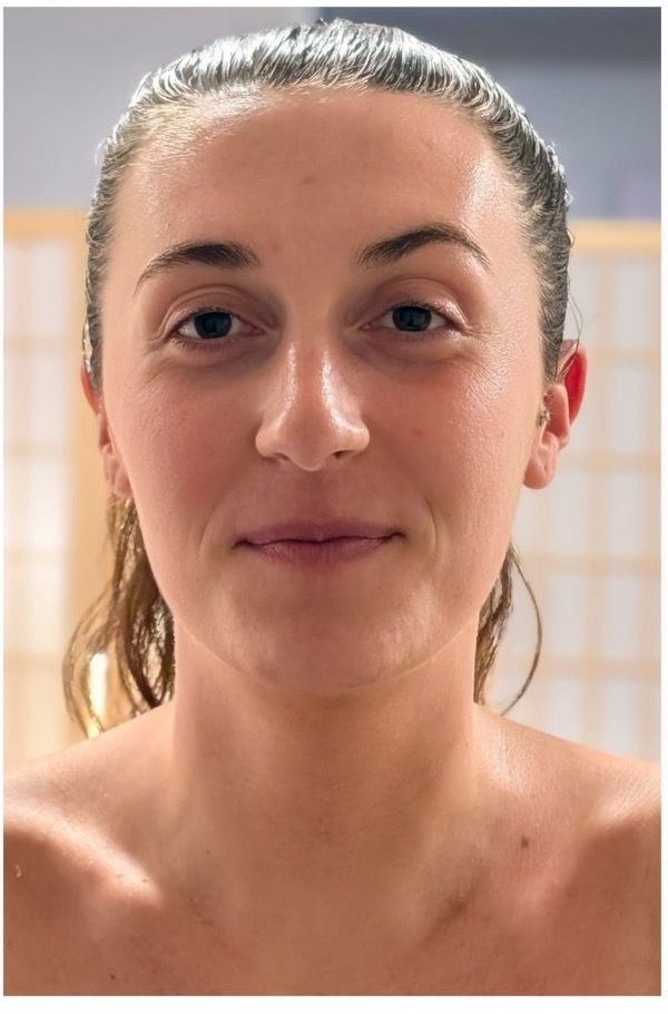 After: Marie A, facial lymphatic drainage massage result